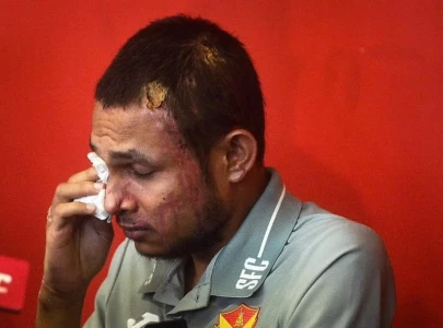 malaysia footballer badly hurt in acid attack pledges to play again malaysia footballer badly hurt in acid attack pledges to play again