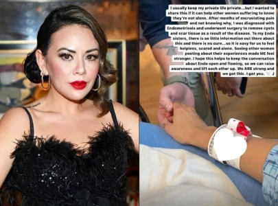 janel parrish opens up about endometriosis surgery