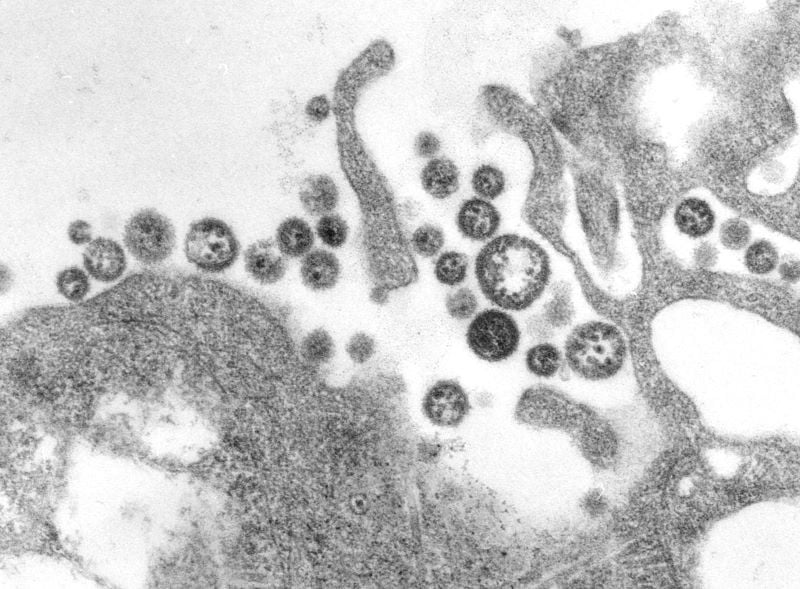 Lassa virus: Iowa man dies from rare fever after recent travel to West Africa