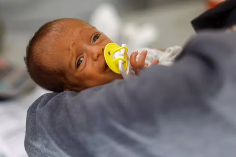 a malnourished palestinian baby receives treatment at the international medical corps field hospital in deir al balah in gaza june 22 2024 photo reuters a malnourished palestinian baby receives treatment at the international medical corps field hospital in deir al balah in gaza june 22 2024 photo reuters