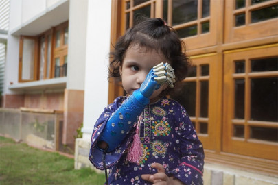 disney s princess elsa inspires little pakistani girl to get a blue prosthetic arm