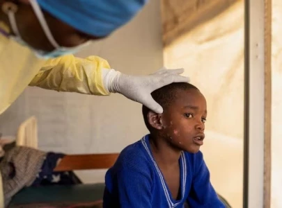 sweden reports first case of mpox outside africa following who emergency declaration sweden reports first case of mpox outside africa following who emergency declaration