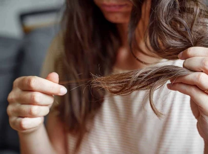 pcos and hair loss understanding the causes symptoms treatment options pcos and hair loss understanding the causes symptoms treatment options