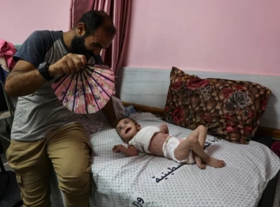 skin diseases spreading rapidly among gaza children skin diseases spreading rapidly among gaza children