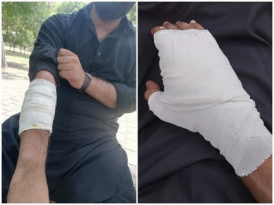 four students injured in hostel clash four students injured in hostel clash