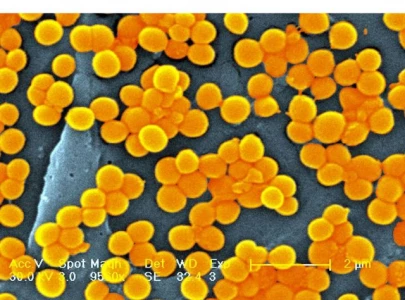 superbug crisis could claim 40 million lives by 2050 study warns