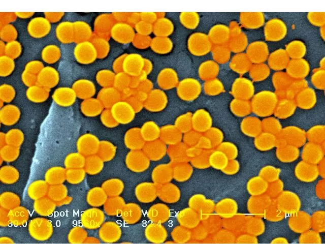 image superbug crisis image superbug crisis