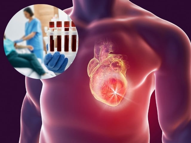 this 5 minute at home test could save you from a heart attack