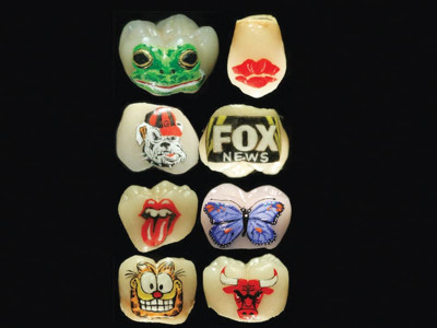 grin and bare it with a dental tattoo