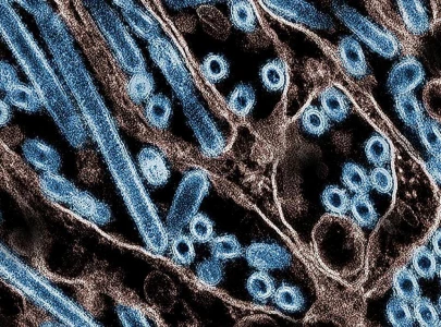us reports first bird flu case in a child