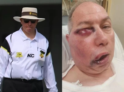 australian umpire hospitalised after being hit by ball