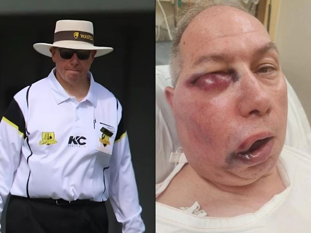 australian umpire hospitalised after being hit by ball