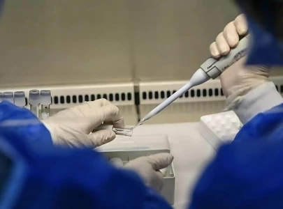 k p confirms third mpox case at peshawar airport