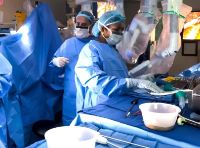 world s first fully robotic heart transplant performed in saudi arabia