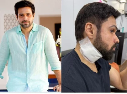 emraan hashmi injured on set of goodachari 2 while filming action scene