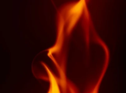 woman burnt by husband for demanding money for food
