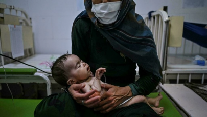 afghan babies succumb to hunger as winter descends