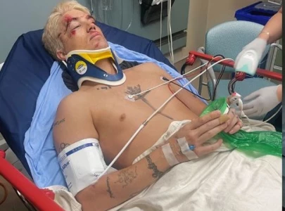 lany s paul klein hospitalised after vespa accident tour dates rescheduled