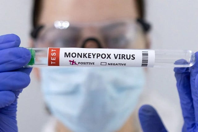test tubes labelled monkeypox virus positive are seen in this illustration taken may 23 2022 photo reuters test tubes labelled monkeypox virus positive are seen in this illustration taken may 23 2022 photo reuters