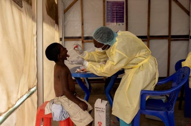 a laboratory nurse takes a sample from a child declared a suspected case mpox at a treatment centre in munigi north kivu province democratic republic of the congo on july 19 2024 photo reuters a laboratory nurse takes a sample from a child declared a suspected case mpox at a treatment centre in munigi north kivu province democratic republic of the congo on july 19 2024 photo reuters