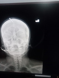 identity of victim a mystery in faith healer case identity of victim a mystery in faith healer case