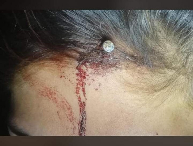the affected woman has been identified as baaz gul whose a mother of three children including two sons and one daughter photo express the affected woman has been identified as baaz gul whose a mother of three children including two sons and one daughter photo express