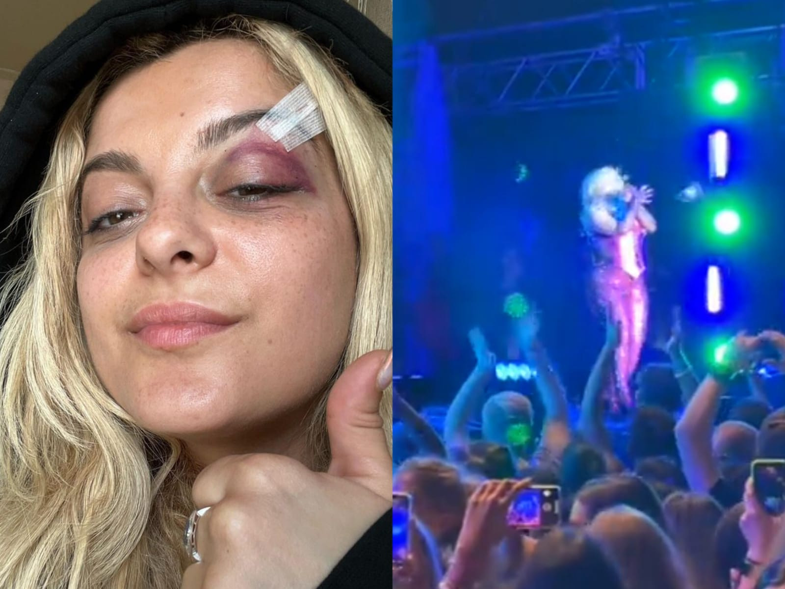 Fan threw a phone at Bebe Rexha during concert