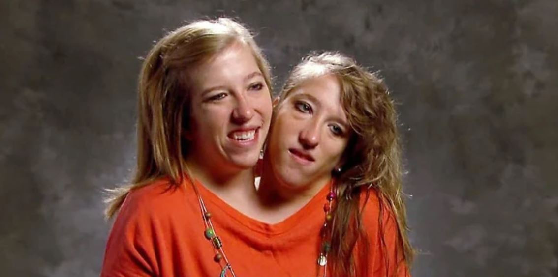 conjoined twin abby hensel reveals 2021 marriage to us army veteran josh bowling