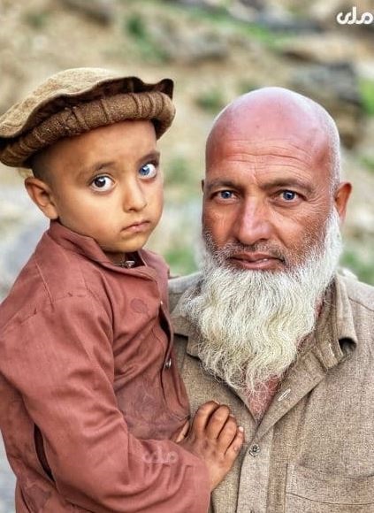 Five-year-old Emran. PHOTO: The Radio Television Afghanistan.