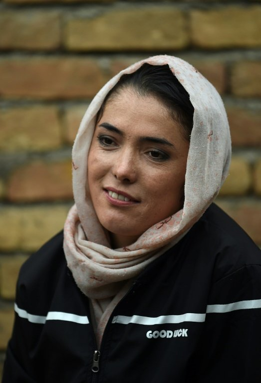 Cyclist Kobra Samim took part in the #MyRedLine campaign that aims to protect womenâs hard-won advancements in Afghanistan. PHOTO: AFP