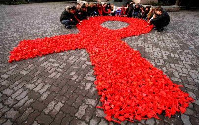 researchers report possible cure for aids