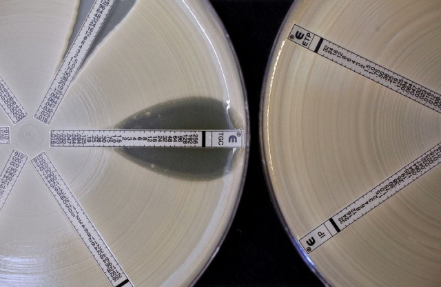 two plates which were coated with an antibiotic resistant bacteria called klebsiella with a mutation called ndm 1 and then exposed to various antibiotics are seen at the health protection agency in north london march 9 2011 photo reuters file two plates which were coated with an antibiotic resistant bacteria called klebsiella with a mutation called ndm 1 and then exposed to various antibiotics are seen at the health protection agency in north london march 9 2011 photo reuters file