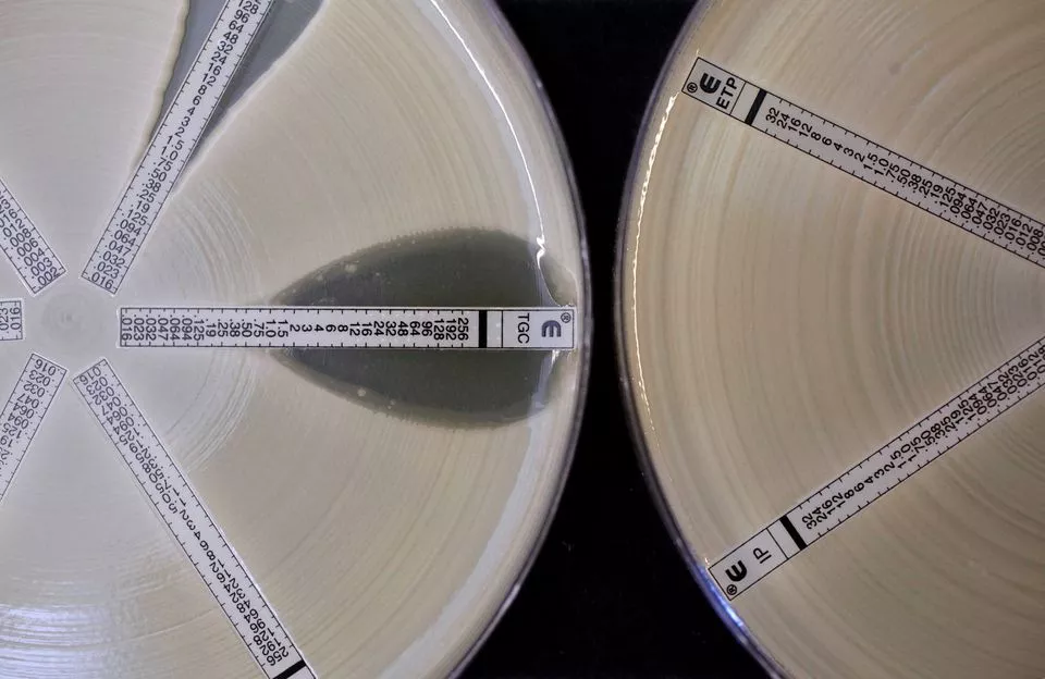 two plates which were coated with an antibiotic resistant bacteria called klebsiella with a mutation called ndm 1 and then exposed to various antibiotics are seen at the health protection agency in north london march 9 2011 photo reuters file two plates which were coated with an antibiotic resistant bacteria called klebsiella with a mutation called ndm 1 and then exposed to various antibiotics are seen at the health protection agency in north london march 9 2011 photo reuters file