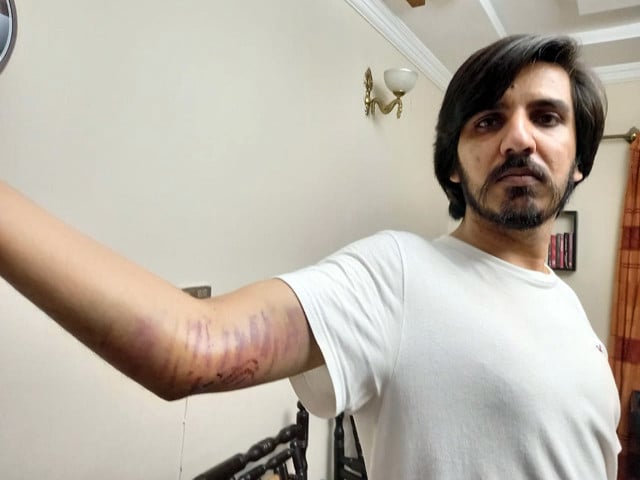 toor was reportedly attacked in islamabad late tuesday may 25 as the attackers broke into his house and physically assaulted him photo twitter asadatoor
