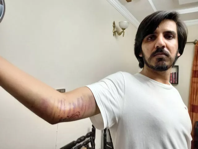 isi rubbishes allegations of attack on journalist asad ali toor isi rubbishes allegations of attack on journalist asad ali toor
