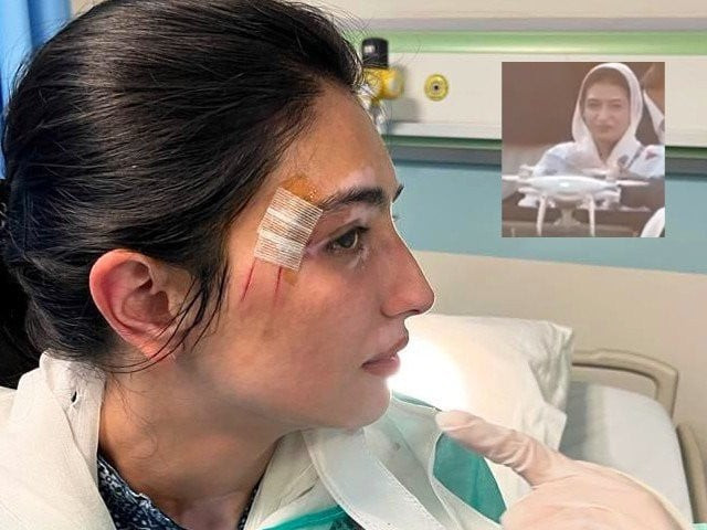 aseefa suffered minor injuries on her face after a drone camera of a private tv channel hit her in khanewal on march 4 photo express aseefa suffered minor injuries on her face after a drone camera of a private tv channel hit her in khanewal on march 4 photo express