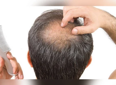 struggling with hair loss here s how to stop it struggling with hair loss here s how to stop it