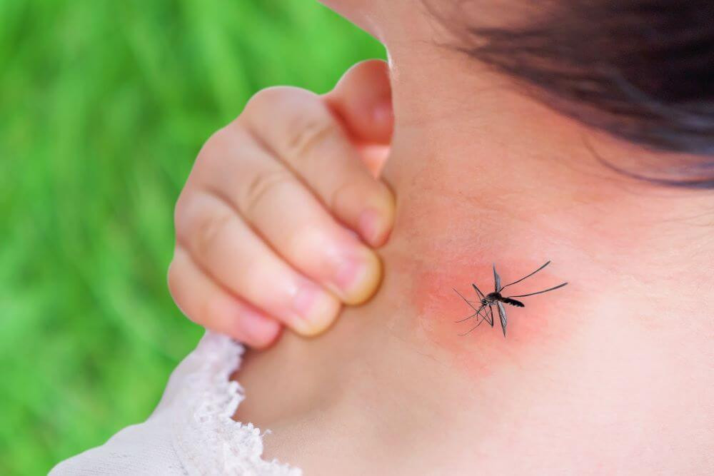 Seven tips to avoid mosquito bites