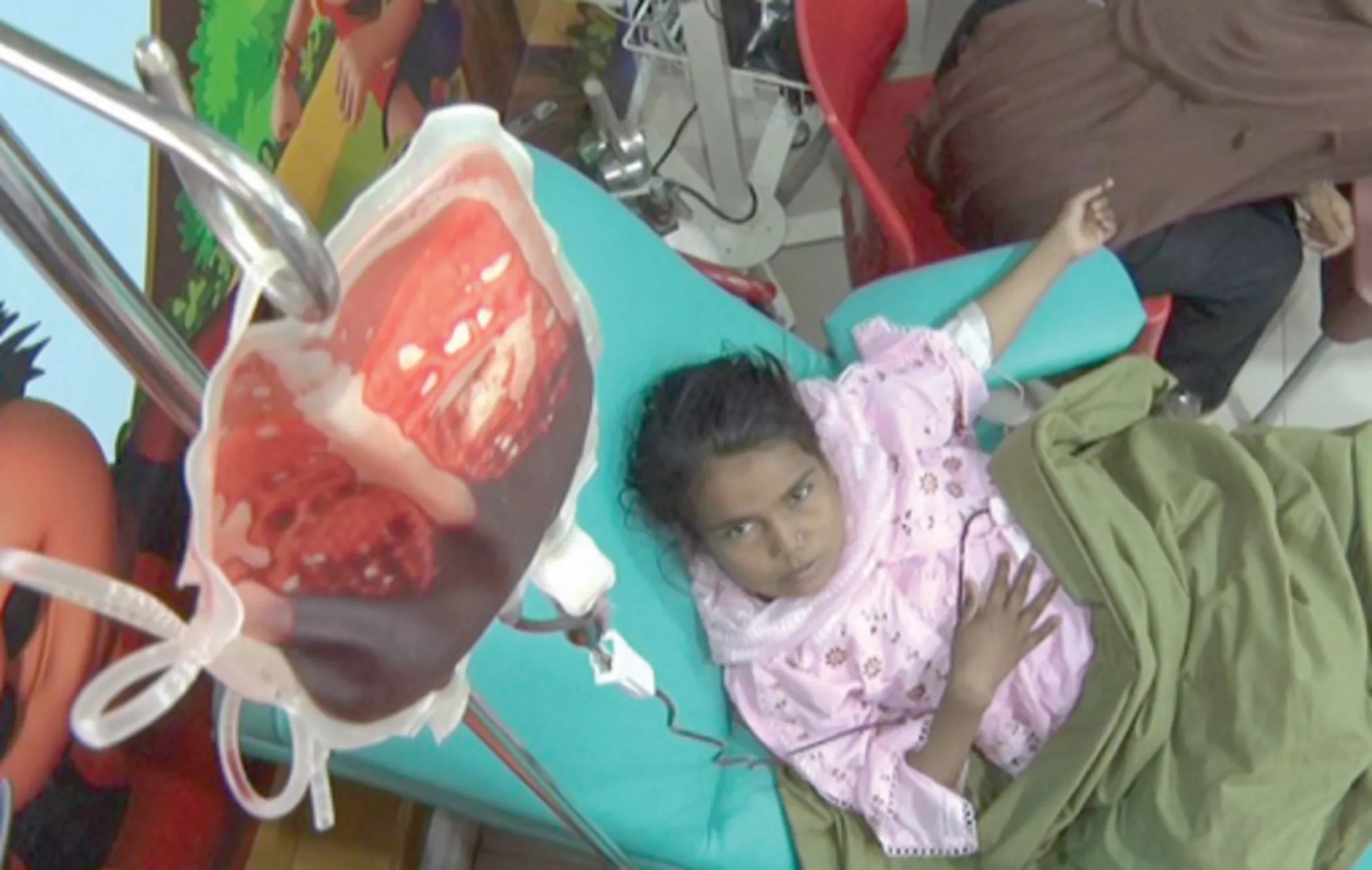 a child suffering from thalassemia receives a blood transfusion at a welfare facility in karachi photo express a child suffering from thalassemia receives a blood transfusion at a welfare facility in karachi photo express