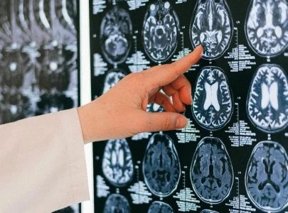 pakistan s first genetic molecular lab inaugurated