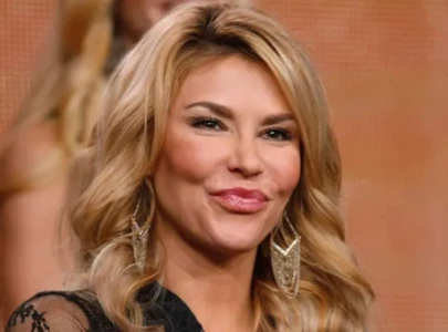 brandi glanville to sue bravo for stress induced health issues i m too swollen for onlyfans