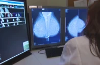 high cost main challenge to treat cancer patients experts