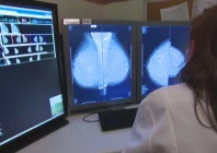 federal health minister urges breast cancer screening federal health minister urges breast cancer screening