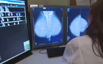 federal health minister urges breast cancer screening federal health minister urges breast cancer screening