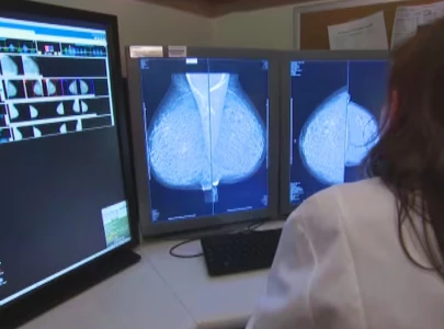 women urged to prioritise breast cancer prevention women urged to prioritise breast cancer prevention