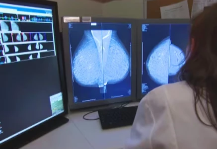 high cost main challenge to treat cancer patients experts