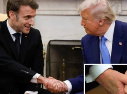 trump s hand bruise doctors explain possible causes dismiss concerns