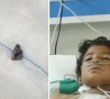bullet removed from 12 year old s heart at nicvd bullet removed from 12 year old s heart at nicvd
