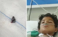 bullet removed from 12 year old s heart at nicvd
