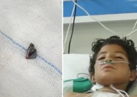 bullet removed from 12 year old s heart at nicvd bullet removed from 12 year old s heart at nicvd